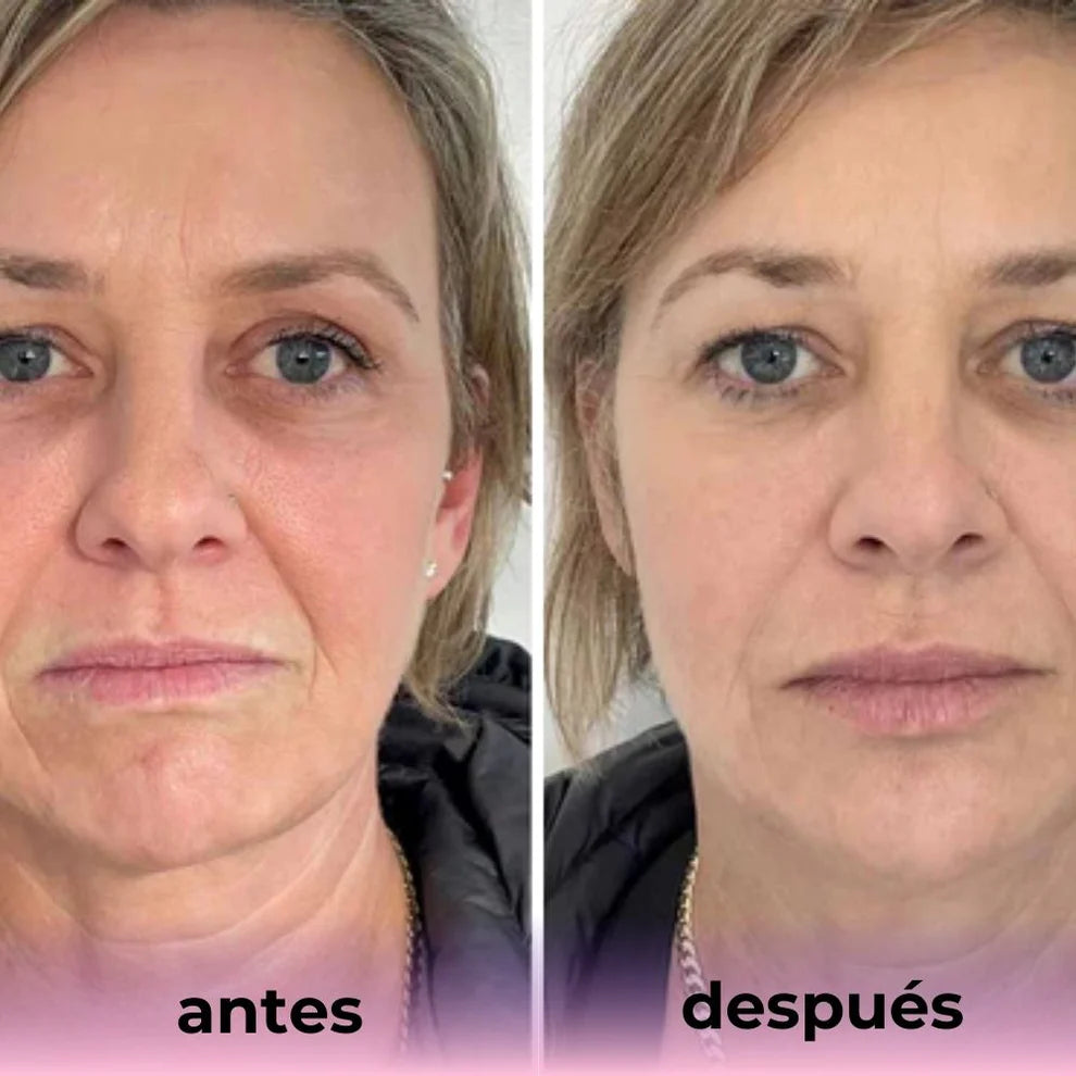 Mascarilla de Bio-Colágeno Biomask™