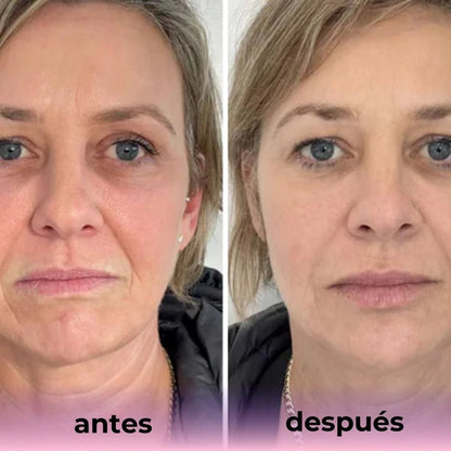 Mascarilla de Bio-Colágeno Biomask™